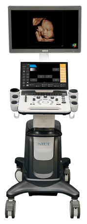 SIUI A30 on-platform ultrasound system