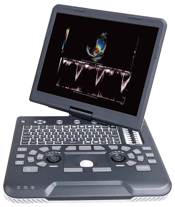 SIUI Apogee 1000 portable ultrasound system