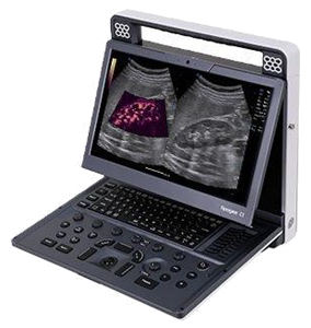 SIUI portable ultrasound system representing Apogee C1